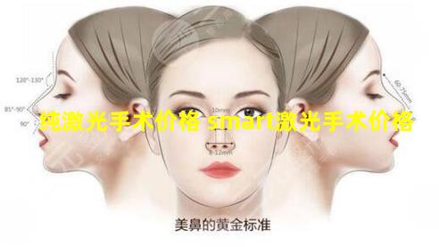 纯激光手术价格 smart激光手术价格